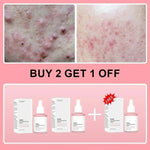 Salmon PDRN Collagen Peptide Facial Serum