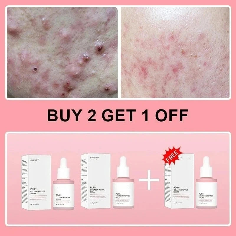 Salmon PDRN Collagen Peptide Facial Serum