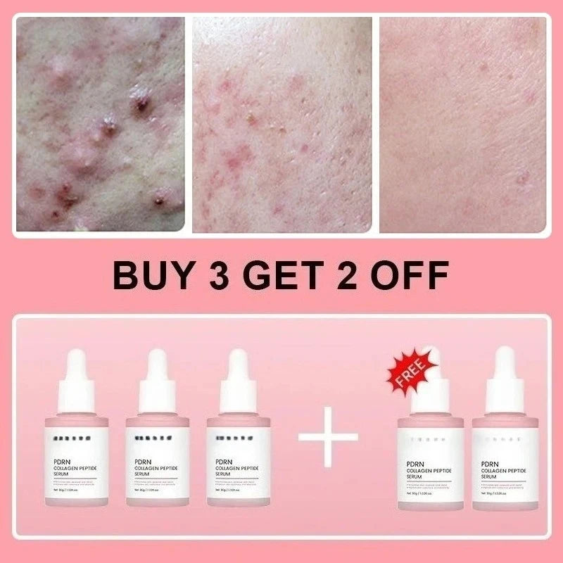 Salmon PDRN Collagen Peptide Facial Serum